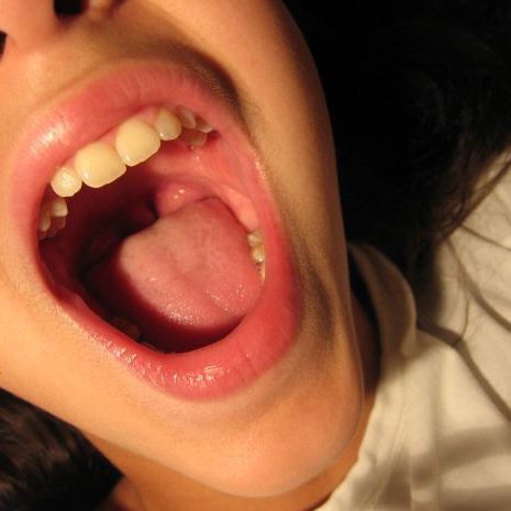 oral cancer screenings having your dentist check for oral cancer