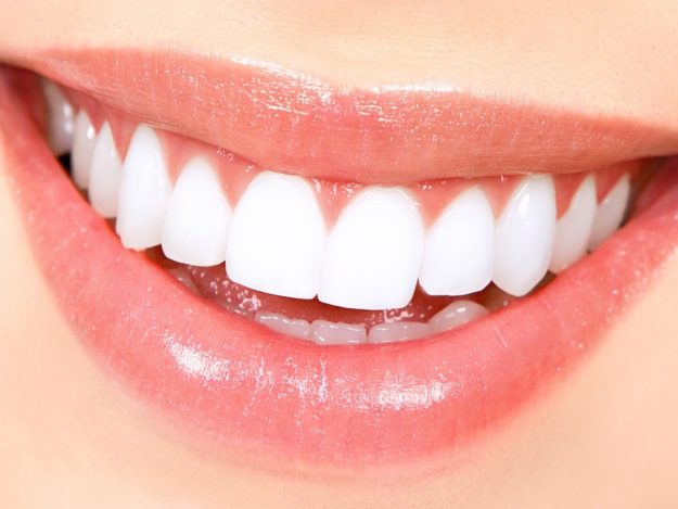 Teeth Whitening Smiles of Bellevue