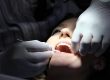 professionally whitened teeth