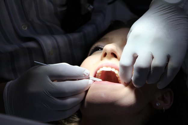 teeth whitening in office (1) professionally whitened teeth